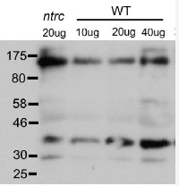 PRK ribulose-5-P-kinase | Phosphoribulokinase in the group Antibodies Plant/Algal / Photosynthesis / RUBISCO/Carbon metabolism at Agrisera AB (Antibodies for research) (AS07 257)